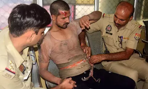 मां और बहन की हत्‍या कर पुलिस पर एसिड फेंकने वाले आरिफ का खुलासा, बोला- भाई आजम माफिया अतीक के लिए करता था काम