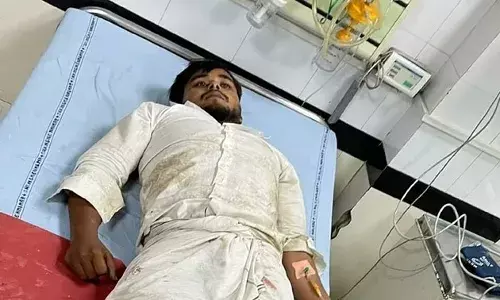 Nuh Violence: नूंह हिंसा के एक और आरोपी की पुलिस से मुठभेड़, ओसामा को गोली मारी गई, नलहड़ में लगाई आग