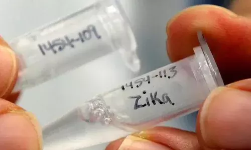 Zika Virus: जीका वायरस क्या है? जानें इसके लक्षण, कारण और राहत के उपाय Zika Virus: जीका वायरस क्या है? जानें इसके लक्षण, कारण और राहत के उपाय