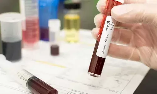 कानपुर: डेंगू के रिकॉर्ड 31 संक्रमित मिले, स्ट्रेन पता करने के लिए 65 सैंपल भेजे, हाईग्रेड फीवर से दो की मौत