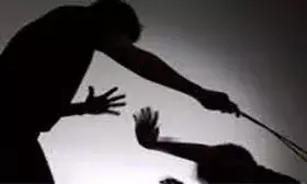 डरे सहमे बच्चों ने बताई बर्बरता की कहानी, बोलीं- मैम डंडा लेकर आईं और बुरी तरह से पीटने लगीं