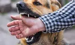 कुत्ते ने काटा तो खुद को कुत्ता समझ भौंकने लगा किशोर, बैठने से खाने तक बदला अंदाज; जांच में मिली ये बीमारी