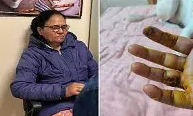 आपस में लड़ रहे कुत्तों को छुड़ाने गई महिला के हाथ में काटा, सीरम लगवाने को भटकती रहीं इधर से उधर आपस में लड़ रहे कुत्तों को छुड़ाने गई महिला के हाथ में काटा, सीरम लगवाने को भटकती रहीं इधर से उधर