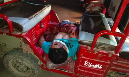 तेज रफ्तार बाइक डिवाइडर से टकराई, दो युवक गंभीर रूप से घायल तेज रफ्तार बाइक डिवाइडर से टकराई, दो युवक गंभीर रूप से घायल