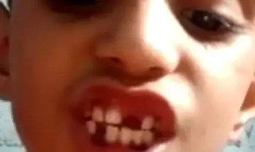 दबंगों ने घर में घुसकर दलितों के साथ मारपीट की, 6 साल की बच्ची की टूटा दांत दबंगों ने घर में घुसकर दलितों के साथ मारपीट की, 6 साल की बच्ची की टूटा दांत