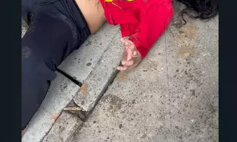 रील बनाने के चक्कर मे 6ठी मंजिल से गिरी छात्रा, अस्पताल में भर्ती रील बनाने के चक्कर मे 6ठी मंजिल से गिरी छात्रा, अस्पताल में भर्ती