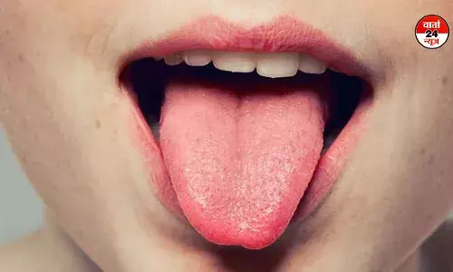 जीभ का रंग और आकार देख कर शरीर के स्वास्थ्य के बारे में लगाएं पता