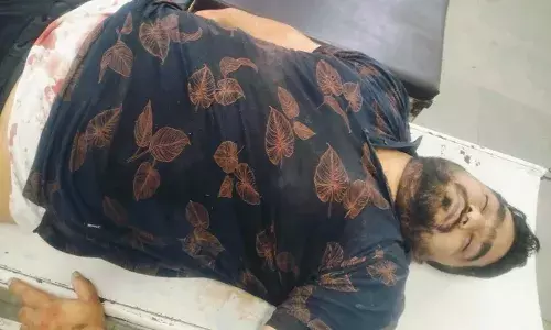 UP: मुख्तार अंसारी गिरोह का शूटर मुजफ्फरनगर में मुठभेड़ के बाद ढेर UP: मुख्तार अंसारी गिरोह का शूटर मुजफ्फरनगर में मुठभेड़ के बाद ढेर