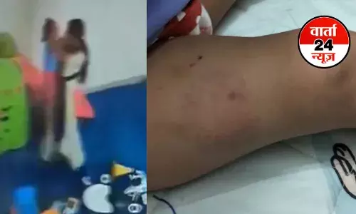 मेड ने बच्ची को बेल्ट से पीटते हुए जमीन पर पटक दिया, जांघों पर दांतों से काटा...ये सीन है नोएडा के एक डे केयर सेंटर की...देखें वीडियो