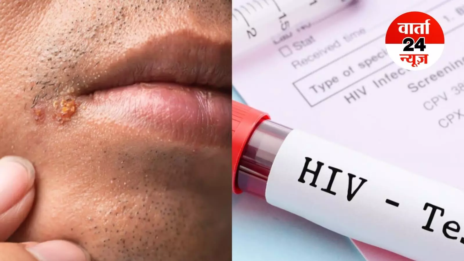 ऑनलाइन डेटिंग एप पर समलैंगिक युवक से दोस्ती पड़ी मंहगी, दोनों ने बनाए यौन संबंध, शादीशुदा युवक हुआ HIV संक्रमित ऑनलाइन डेटिंग एप पर समलैंगिक युवक से दोस्ती पड़ी मंहगी, दोनों ने बनाए यौन संबंध, शादीशुदा युवक हुआ HIV संक्रमित