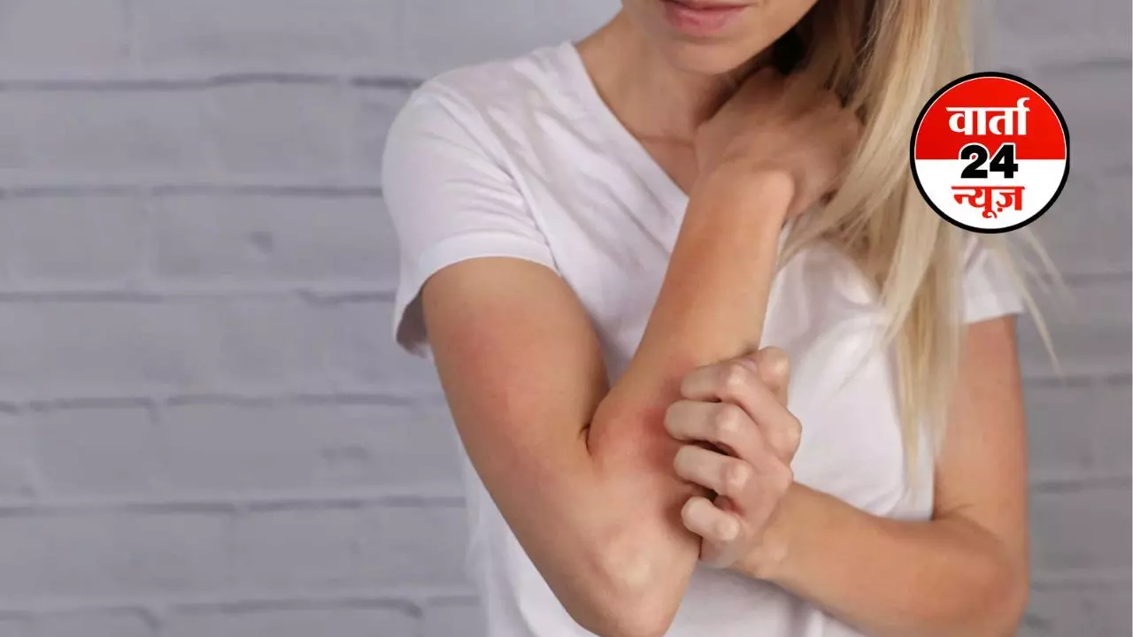 Allergies: यदि आपकी बॉडी में इचिंग या बार-बार सर्दी हो रही हो तो इसका कारण एलर्जी है, जानें लक्षण और बचाव के आसान उपाय