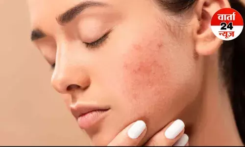 त्वचा के दाग-धब्बों को न करें अनदेखा, यह हो सकते हैं लिवर खराब होने के शुरुआती लक्षण, जानें रोग के अन्य संकेतों के बारे में ... त्वचा के दाग-धब्बों को न करें अनदेखा, यह हो सकते हैं लिवर खराब होने के शुरुआती लक्षण, जानें रोग के अन्य संकेतों के बारे में ...