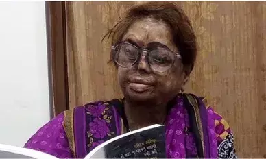 ना झूकूंगी, ना ही टूटूगी... मैं बस लडूंगी! एसिड अटैक सर्वाइवर से पद्मश्री तक, प्रो. मंगला कपूर की प्रेरक कहानी