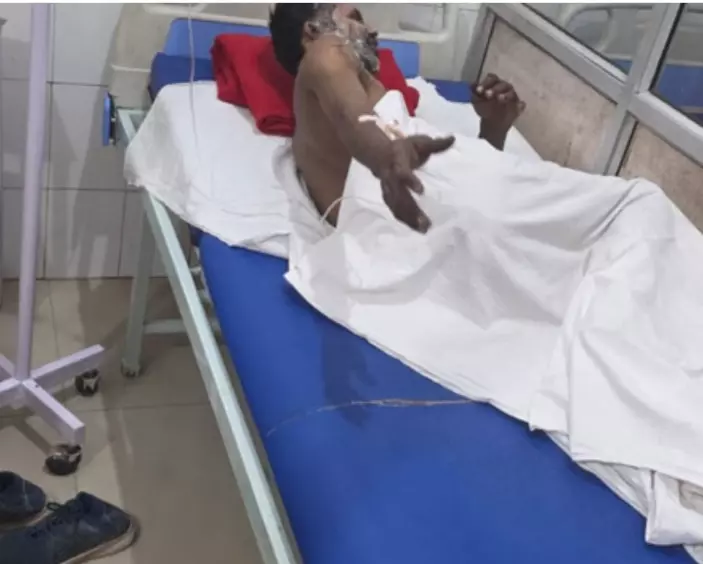 बाइक छुड़वाने के लिए बिरादरी थाने के सामने डिलीवरी बॉय ने खुद को लगाई आग बाइक छुड़वाने के लिए बिरादरी थाने के सामने डिलीवरी बॉय ने खुद को लगाई आग